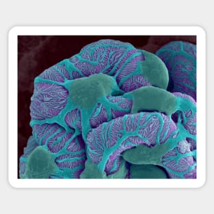 Kidney glomerulus, SEM (C031/9778) Sticker